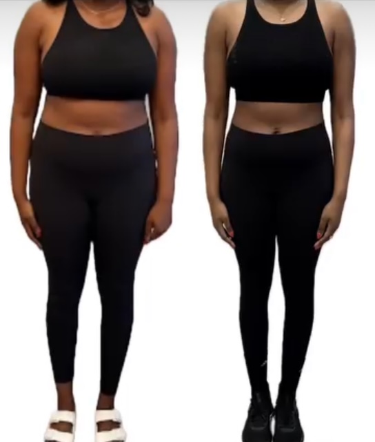 Before and after weight loss waistline transformation