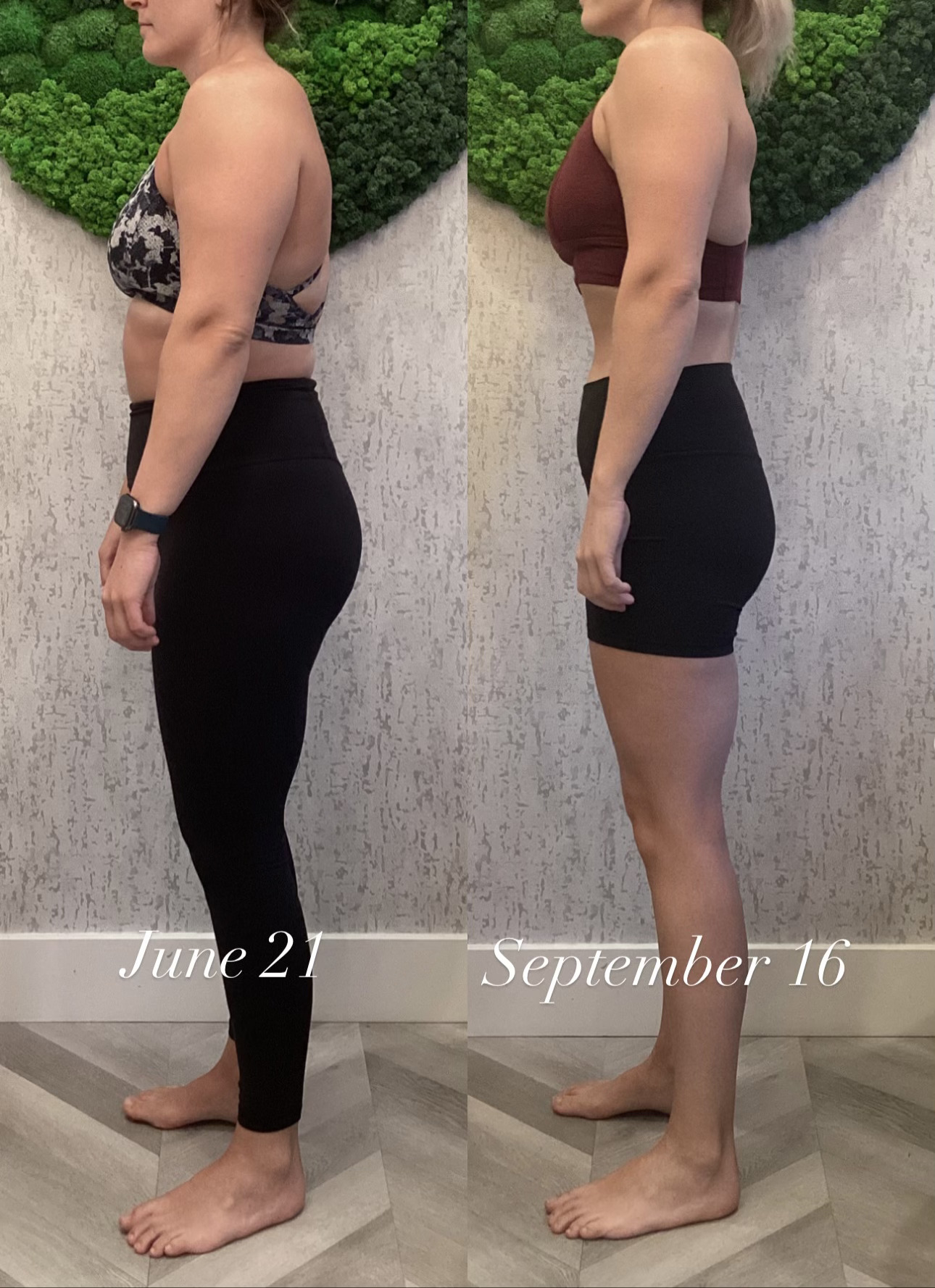 Before and after weight loss results