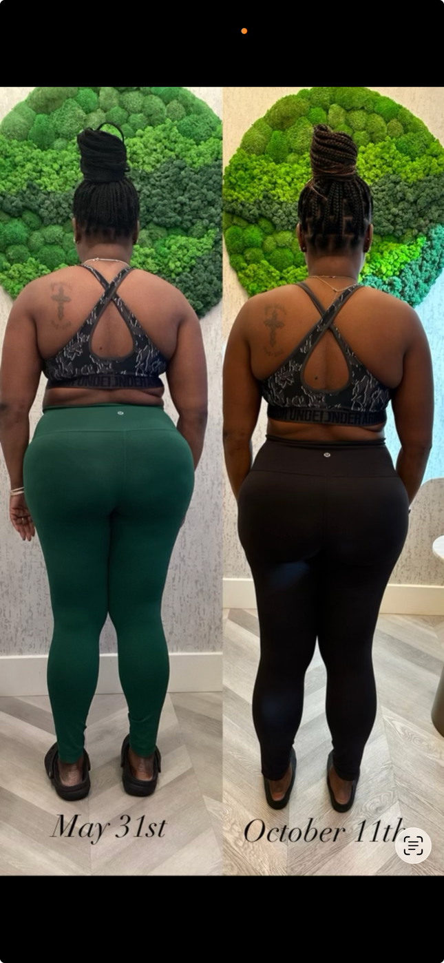 Before and after weight loss back view transformation