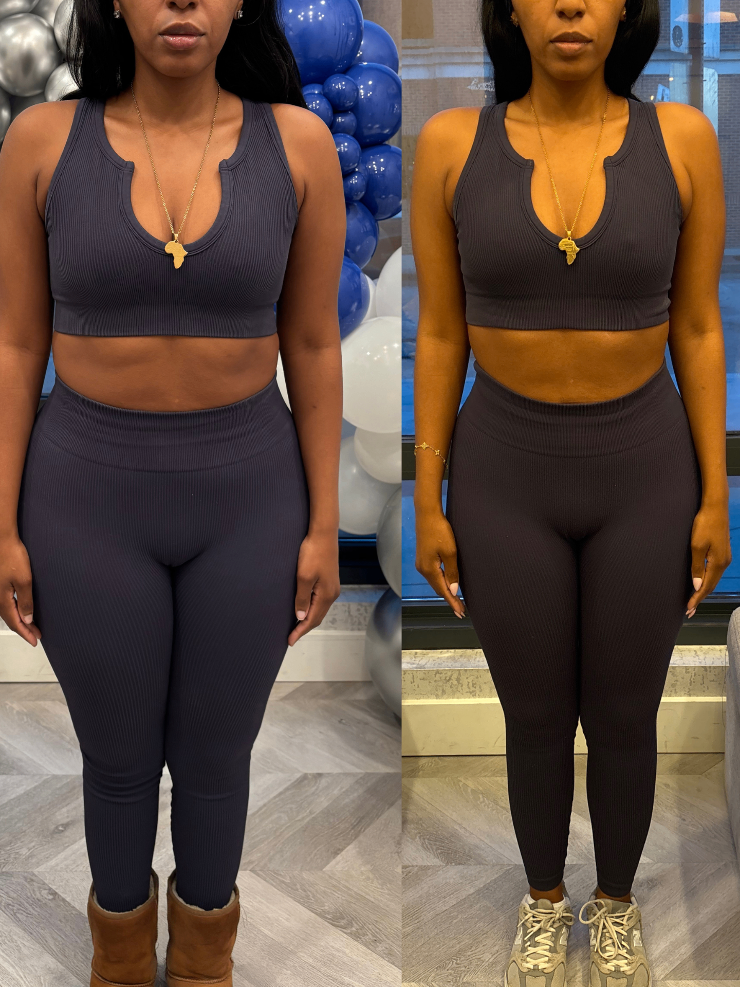 Before and after weight loss full body transformation