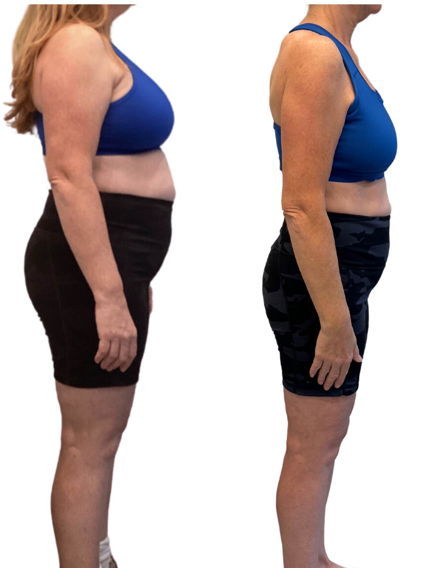 Before and after weight loss side profile transformation
