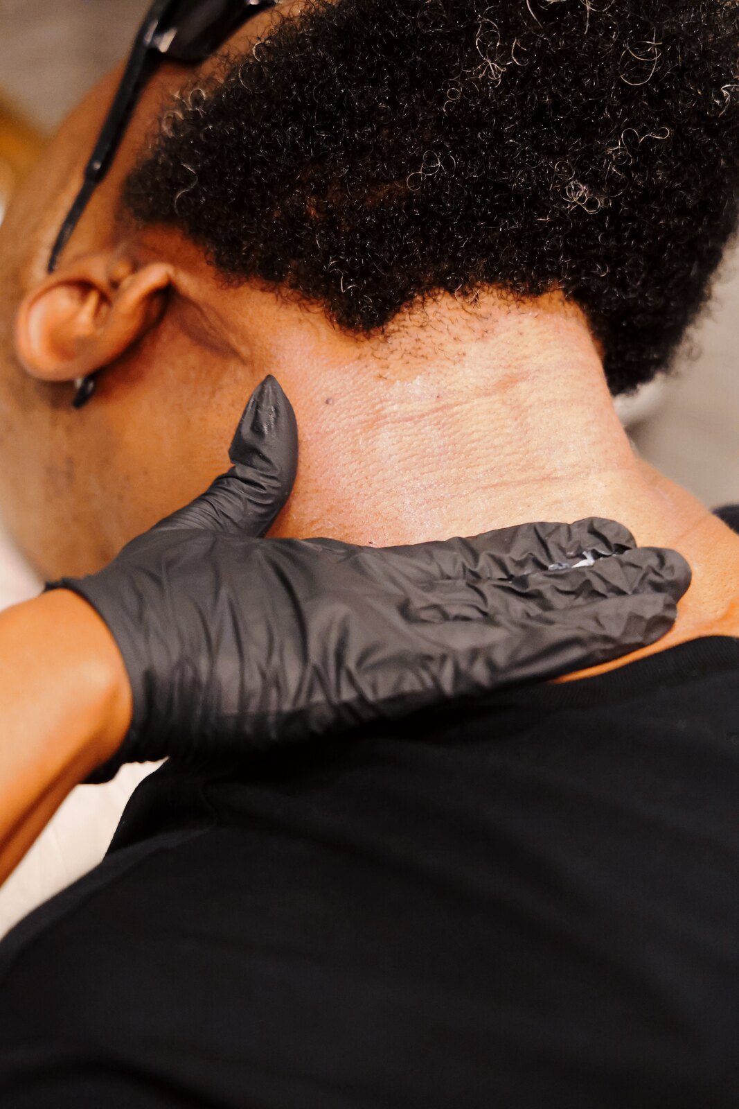 Gloved esthetician performing a laser hair removal treatment on a client's neck
