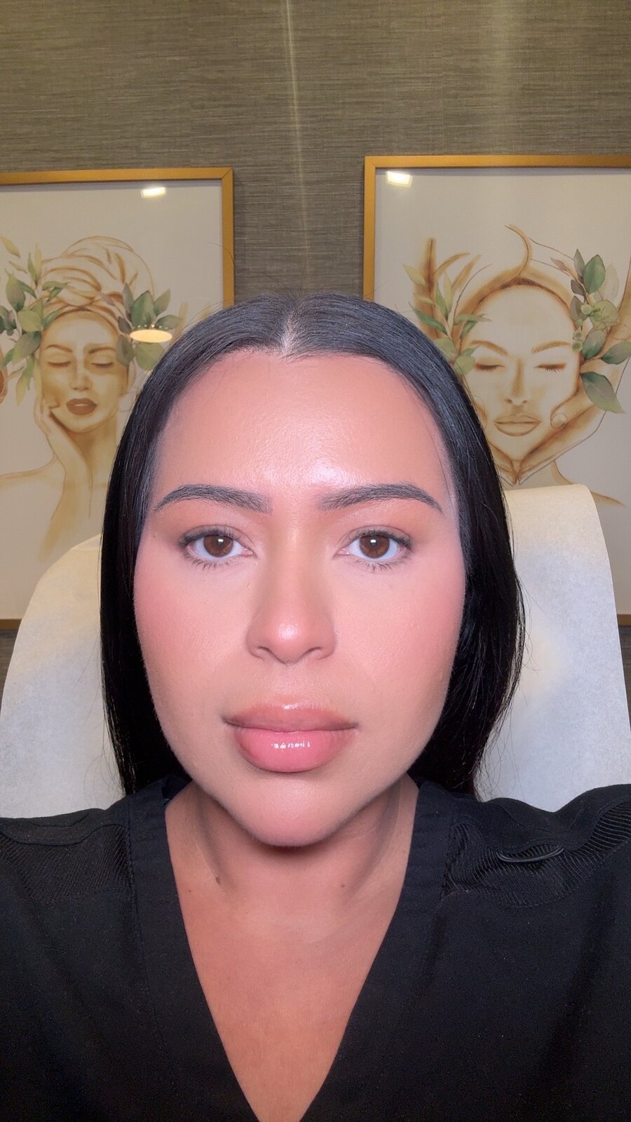 Client with smooth, refreshed skin after neurotoxin treatment